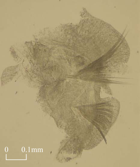 Setae of Spionidae (Click to enlarge)