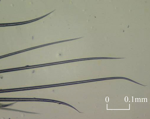 Setae of Sternaspis scutata (Click to enlarge)