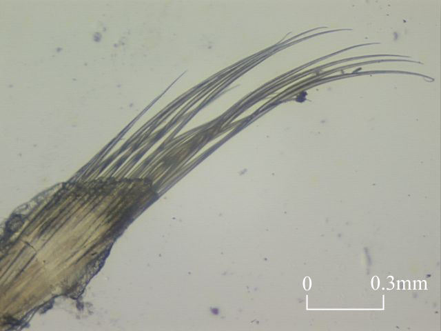 Setae of Terebellidae (Click to enlarge)